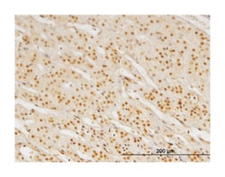 pre-B-cell leukemia homeobox 3, Mouse, Clone: 1A11, Abnova 100&mu;g; Unlabeled:Antibodies,