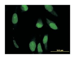 PRPH, Mouse, Clone: 3B3, Abnova 100&mu;g; Unlabeled:Antibodies, Monoclonal