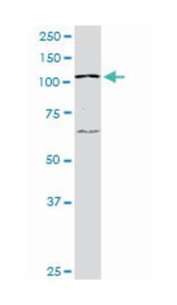 PTK2 (M03), Mouse anti-Human, Clone: 1D7, Abnova 50 &mu;g | Buy Online | Abnova Corporation | Fisher Scientific