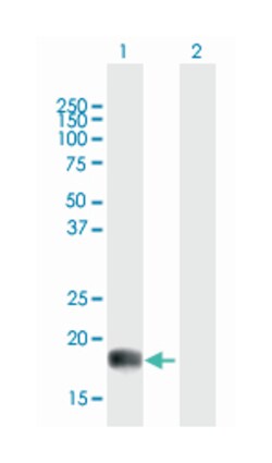 Ras homolog enriched in brain, Mouse, Polyclonal Antibody, Abnova 50&mu;L;