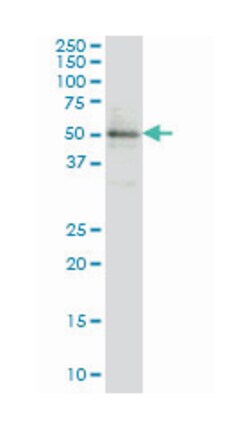 ETV5, Mouse, Clone: 3B10, Abnova 100&mu;g; Unlabeled:Antibodies, Monoclonal