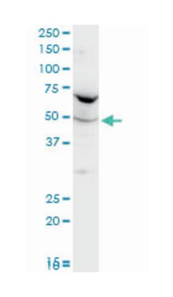 phenylalanyl-tRNA synthetase, alpha subunit (A01), Mouse anti-Human, Mouse,