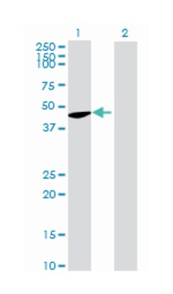 flotillin 2, Mouse, Polyclonal Antibody, Abnova 50 &mu;L | Buy Online | Abnova Corporation | Fisher Scientific