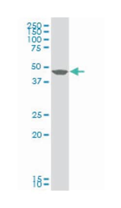 growth differentiation factor 2, Mouse, Polyclonal Antibody, Abnova 50&mu;L;