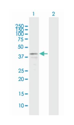 FOXA3, Mouse, Polyclonal Antibody, Abnova 50&mu;L; Unlabeled:Antibodies,