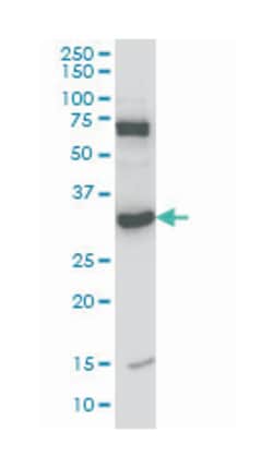 N-methylpurine-DNA glycosylase, Mouse, Clone: 2C5, Abnova 100&mu;g; Unlabeled:Antibodies,