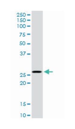MSX1, Rabbit, MaxPab Polyclonal Antibody, Abnova 100 &mu;L | Buy Online | Abnova Corporation | Fisher Scientific