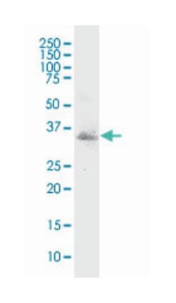MSX1, Mouse, Clone: 1E2, Abnova&trade;