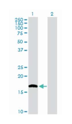 nudix (nucleoside diphosphate linked moiety X)-type motif 1, Rabbit, Purified