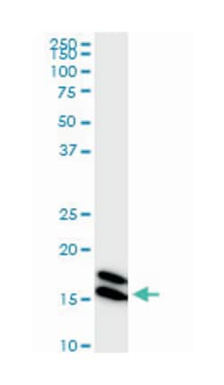 nonmetastatic cells 1, protein (NM23A) expressed in, Mouse, Clone: 1D7,