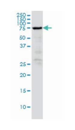 RDX (M03), Mouse anti-Human, Clone: 1F6, Abnova 100&mu;g; Unlabeled:Antibodies,