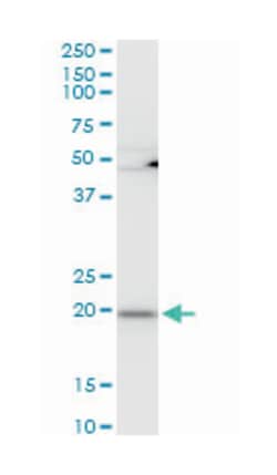ribosomal protein L21, Mouse, Polyclonal Antibody, Abnova 50&mu;L; Unlabeled:Antibodies,