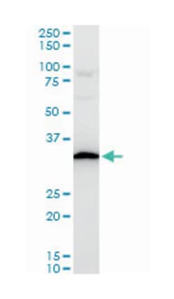 ribosomal protein S3A, Mouse, Polyclonal Antibody, Abnova 50μL; Unlabeled:Antibodies,