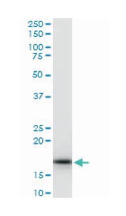 ribosomal protein S17, Mouse, Polyclonal Antibody, Abnova 50&mu;L; Unlabeled:Antibodies,