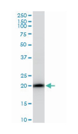SAT, Mouse, Polyclonal Antibody, Abnova 50&mu;L; Unlabeled:Antibodies,