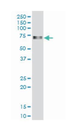 serum response factor (c-fos serum response element-binding transcription