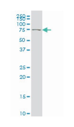 TBX2, Mouse, Clone: 7G5, Abnova 200 &mu;L | Buy Online | Abnova | Fisher Scientific