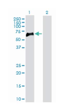 tumor necrosis factor receptor superfamily, member 1B, Rabbit, Purified MaxPab™ Polyclonal Antibody, Abnova™