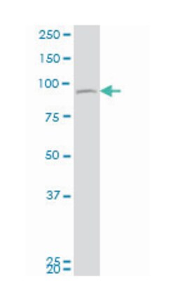 TTK protein kinase, Mouse, Clone: 4G9, Abnova™
