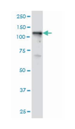 tyrosine kinase 2, Mouse, Clone: 5A4, Abnova 100 &mu;g | Buy Online | Abnova | Fisher Scientific