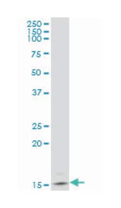 ubiquitin-conjugating enzyme E2D 2 (UBC4/5 homolog, yeast), Mouse, Polyclonal
