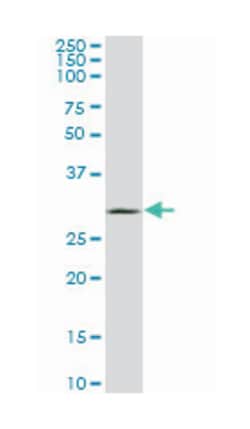 uncoupling protein 1 (mitochondrial, proton carrier), Mouse, Clone: 4B7,