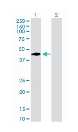 vaccinia related kinase 1, Rabbit, Purified MaxPab Polyclonal Antibody, Abnova 100 &mu;g | Buy Online | Abnova Corporation | Fisher Scientific