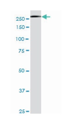 USP9X, Mouse, Clone: 5D7, Abnova 200&mu;L; Unlabeled:Antibodies, Monoclonal