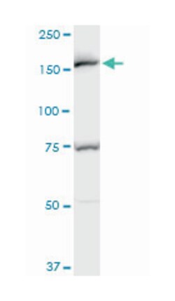 early endosome antigen 1, Mouse, Polyclonal Antibody, Abnova 50&mu;L; Unlabeled:Antibodies,