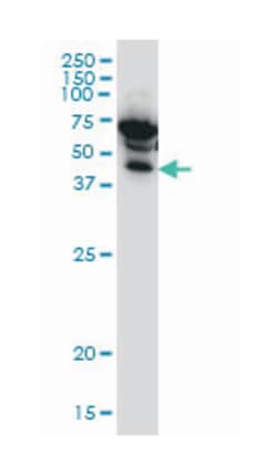 inhibitor of kappa light polypeptide gene enhancer in B-cells, kinase gamma, Mouse, Clone: 1D4, Abnova 100 &mu;g | Buy Online | Abnova Corporation | Fisher Scientific