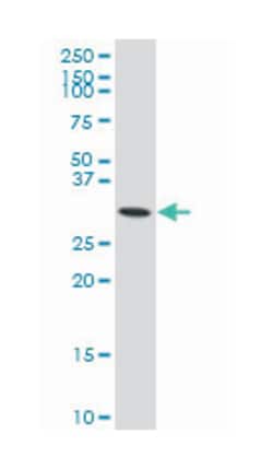 protein kinase, interferon-inducible double stranded RNA dependent activator, Mouse, Polyclonal Antibody, Abnova 50 &mu;L | Buy Online | Abnova | Fisher Scientific
