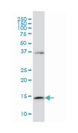 endosulfine alpha, Mouse, Clone: 1H7, Abnova 100&mu;g; Unlabeled:Antibodies,