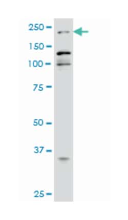 E1A binding protein p300, Mouse, Clone: 1D2, Abnova 50&mu;g; Unlabeled:Antibodies,