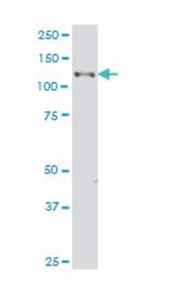 EPHB3, Mouse, Clone: 2G9, Abnova 100&mu;g; Unlabeled:Antibodies, Monoclonal