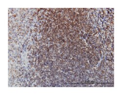 EPHB3, Mouse, Clone: 2G9, Abnova 100&mu;g; Unlabeled:Antibodies, Monoclonal