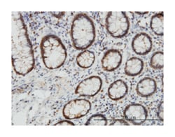 EPHB3 (M04), Mouse anti-Human, Clone: 2G8, Abnova 100&mu;g; Unlabeled:Antibodies,