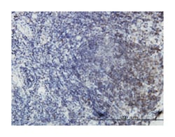 EPHB3, Mouse, Clone: 4E9, Abnova 100&mu;g; Unlabeled:Antibodies, Monoclonal