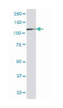 EPHB6, Mouse, Clone: 5H6, Abnova 100 &mu;g | Buy Online | Abnova Corporation | Fisher Scientific