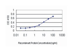 EPHB6, Mouse, Clone: 5H6, Abnova 100 &mu;g | Buy Online | Abnova Corporation | Fisher Scientific