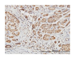 EPH receptor B6, Mouse, Clone: 5D8, Abnova 100&mu;g; Unlabeled:Antibodies,