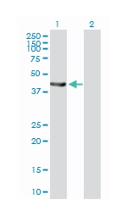 epoxide hydrolase 1, microsomal (xenobiotic), Mouse, Purified MaxPab Polyclonal