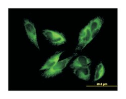 epoxide hydrolase 1, microsomal (xenobiotic), Mouse, Purified MaxPab Polyclonal