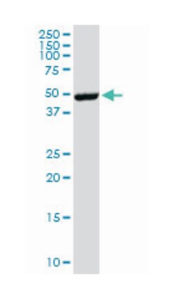 EPOR, Mouse, Clone: 3F6, Abnova 100&mu;g; Unlabeled:Antibodies, Monoclonal