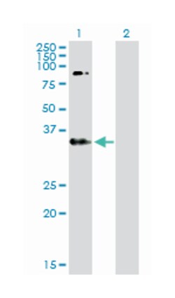 v-erb-b2 erythroblastic leukemia viral oncogene homolog 3 (avian), Rabbit,