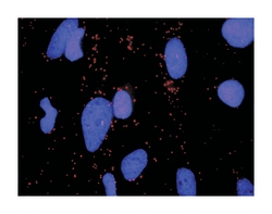 v-erb-b2 erythroblastic leukemia viral oncogene homolog 3 (avian), Rabbit, Purified MaxPab™ Polyclonal Antibody, Abnova™