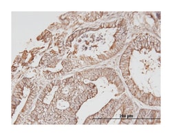 ERBB3, Mouse, Clone: 2C7, Abnova 100&mu;g; Unlabeled:Antibodies, Monoclonal