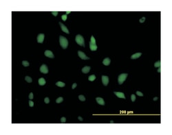 excision repair cross-complementing rodent repair deficiency, complementation