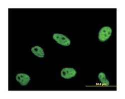 enhancer of rudimentary homolog (Drosophila), Mouse, Clone: 4A10, Abnova 100 &mu;g | Buy Online | Abnova Corporation | Fisher Scientific