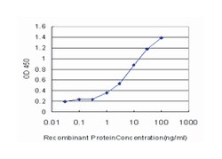 fibrillarin, Mouse, Clone: 3E10, Abnova&trade;