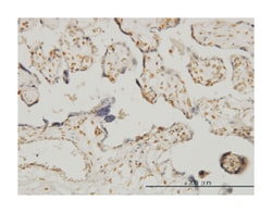 ets variant 6, Mouse, Clone: 3B10, Abnova 100 &mu;g | Buy Online | Abnova Corporation | Fisher Scientific